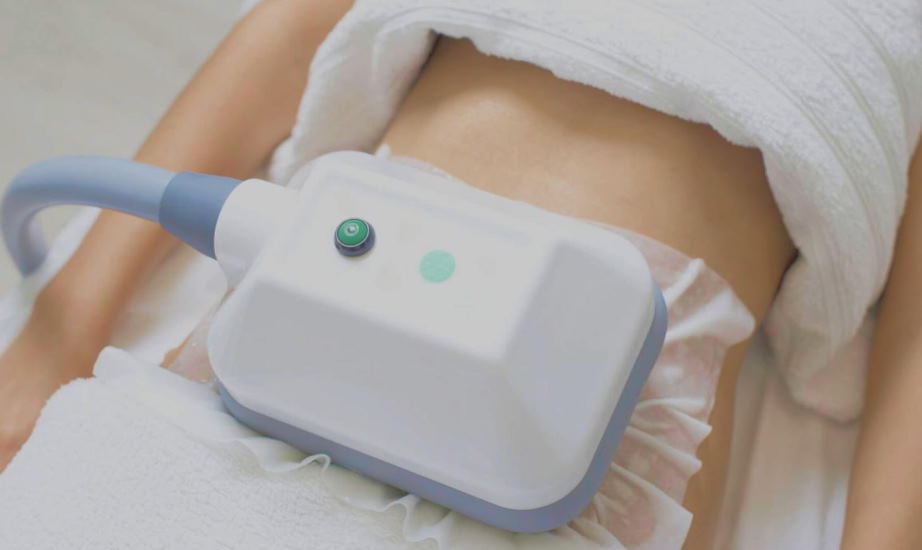 cryolipolysis